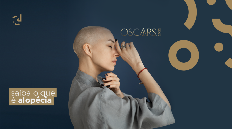 O que é alopecia?